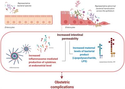 Recent Insights on the Maternal Microbiota: Impact on Pregnancy Outcomes